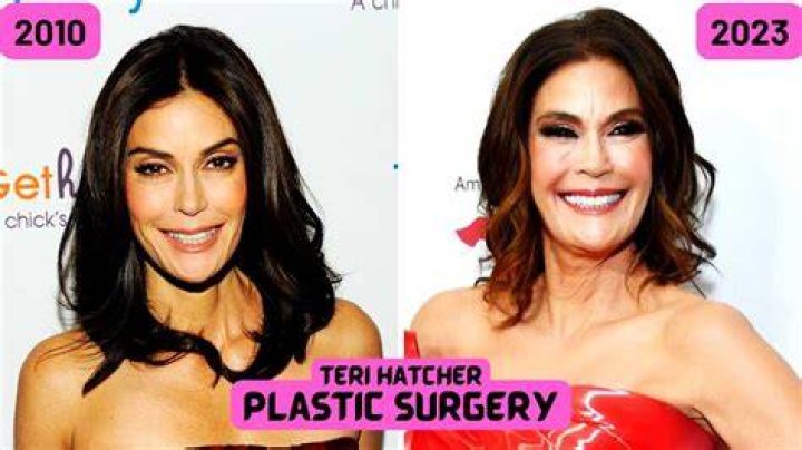 
Teri Hatcher Before Face Lift: All Things We Know About Her Plastic Surgery 